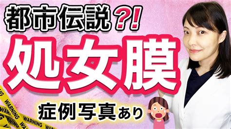 処女 痛み|【女医が解説】痛い？血が出る？処女について学ぼう【産婦人科。